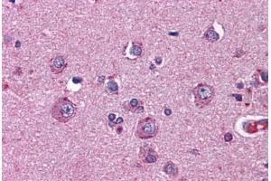 Human Brain, Cortex: Formalin-Fixed, Paraffin-Embedded (FFPE) (Netrin G2 antibody  (AA 21-120))