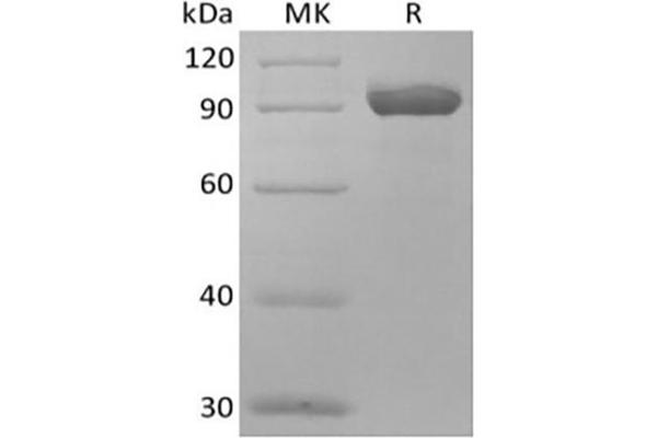 NPR3 Protein (Fc Tag)