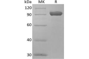 Western Blotting (WB) image for Atrial Natriuretic Peptide Receptor 3 (NPR3) protein (Fc Tag) (ABIN7319905) (NPR3 Protein (Fc Tag))