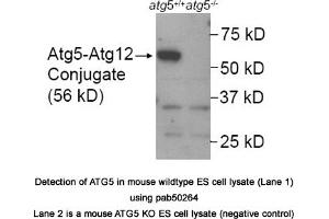 Image no. 1 for anti-ATG5 Autophagy Related 5 (ATG5) (AA 1-50), (N-Term) antibody (ABIN363573) (ATG5 antibody  (N-Term))