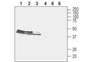 Western blot analysis of rat brain membranes (lanes 1 and 4), mouse brain membranes (lanes 2 and 5) and human SH-SY5Y neuroblastoma cell lysate (lanes 3 and 6): - 1-3. (Solute Carrier Family 17 (Vesicular Glutamate Transporter), Member 6 (SLC17A6) (AA 45-56), (Cytosolic), (N-Term) antibody)