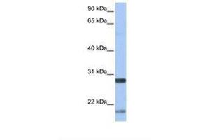 Image no. 1 for anti-Brain-Derived Neurotrophic Factor (BDNF) (AA 146-195) antibody (ABIN6738014)