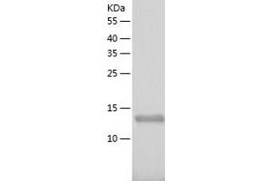 Western Blotting (WB) image for Chibby Homolog 1 (CBY1) (AA 2-126) protein (His tag) (ABIN7122349) (CBY1/PGEA1 Protein (AA 2-126) (His tag))