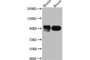Western Blot Positive WB detected in: Rat Brain whole cell lysate, Mouse Brain whole cell lysate All lanes: PSD95 antibody at 1:1000 Secondary Goat polyclonal to rabbit IgG at 1/50000 dilution Predicted band size: 81, 86, 81 kDa Observed band size: 95 kDa (Recombinant DLG4 antibody)