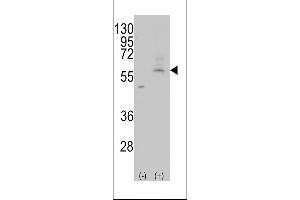 Western blot analysis of PMAT(Slc29a4) using rabbit polyclonal PMAT(Slc29a4) Antibody using 293 cell lysates (2 ug/lane) either nontransfected (Lane 1) or transiently transfected with the PMAT(Slc29a4) gene (Lane 2).
