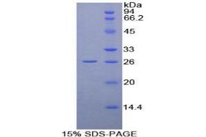 SDS-PAGE analysis of Human Cyclophilin D Protein.