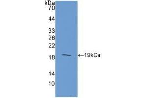 Detection of Recombinant GIP, Human using Polyclonal Antibody to Gastric Inhibitory Polypeptide (GIP) (GIP antibody  (AA 22-153))