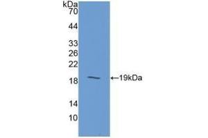 Detection of Recombinant GIP, Human using Polyclonal Antibody to Gastric Inhibitory Polypeptide (GIP) (GIP antibody  (AA 22-153))