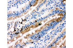 Anti-Egr1 antibody, IHC(F) IHC(F): Rat Intestine Tissue (EGR1 antibody  (N-Term))
