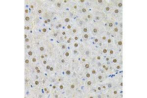 Immunohistochemistry of paraffin-embedded rat liver using SQSTM1 Antibody.