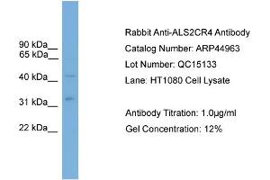 WB Suggested Anti-ALS2CR4  Antibody Titration: 0. (TMEM237 antibody  (Middle Region))