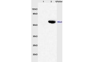 Lane 1: rat liver lysates Lane 2: human colon carcinoma lysates probed with Anti CYP3A4 Polyclonal Antibody, Unconjugated (ABIN733793) at 1:200 in 4 °C. (CYP3A4 antibody  (AA 18-120))