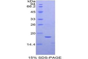 SDS-PAGE analysis of Human TAF13 Protein. (TAF13 Protein)