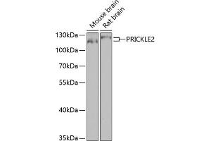 Western blot analysis of extracts of various cell lines, using PRICKLE2 antibody (ABIN6133166, ABIN6146162, ABIN6146163 and ABIN6224046) at 1:1000 dilution.