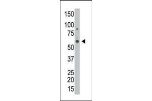 The anti-GALK2 Pab (ABIN391116 and ABIN2841246) is used in Western blot to detect GALK2 in HL-60 cell lysate. (GALK2 antibody  (C-Term))