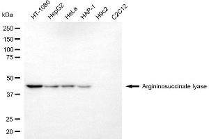 Western blotting analysis using argininosuccinate lyase antibody (ABIN7797646).