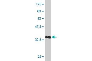 Western Blot detection against Immunogen (36. (Recoverin antibody  (AA 101-199))