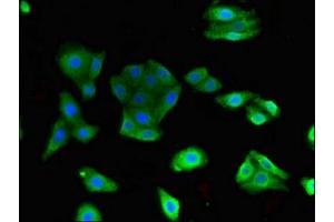 Immunofluorescent analysis of HepG2 cells using ABIN7172286 at dilution of 1:100 and Alexa Fluor 488-congugated AffiniPure Goat Anti-Rabbit IgG(H+L) (TLR9 antibody  (AA 425-563))