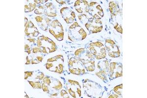 Immunohistochemistry (IHC) image for anti-NADH Dehydrogenase (Ubiquinone) 1 alpha Subcomplex, 5, 13kDa (NDUFA5) (AA 1-116) antibody (ABIN7268804)