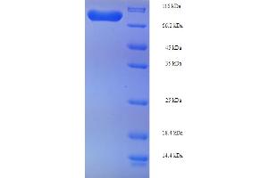 SDS-PAGE (SDS) image for Phosphoglucomutase 1 (PGM1) (AA 1-562), (full length) protein (His-SUMO Tag) (ABIN5710085) (Phosphoglucomutase 1 Protein (PGM1) (AA 1-562, full length) (His-SUMO Tag))