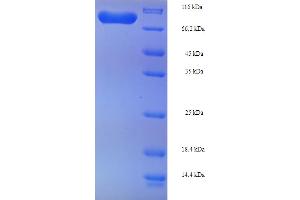SDS-PAGE (SDS) image for Phosphoglucomutase 1 (PGM1) (AA 1-562), (full length) protein (His-SUMO Tag) (ABIN4975858)