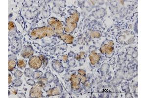 Immunoperoxidase of purified MaxPab rabbit antibody to MMP1 on formalin-fixed paraffin-embedded human colon.