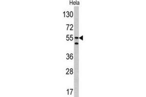 Western Blotting (WB) image for anti-Carbonic Anhydrase IX (CA9) antibody (ABIN3002202) (CA9 antibody)