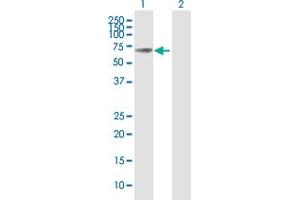 Western Blot analysis of MMP8 expression in transfected 293T cell line by MMP8 MaxPab polyclonal antibody. (MMP8 antibody  (AA 1-467))