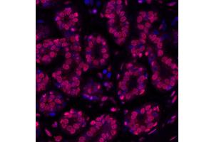 Immunofluorescence (IF) image for anti-gamma Histone Variant H2AX (GAMMA-H2AX) (Ser140) antibody (ABIN7454026) (Recombinant gamma H2AX antibody  (Ser140))
