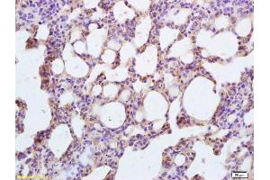 Formalin-fixed and paraffin embedded rat lung labeled with Rabbit Anti CARD4 Polyclonal Antibody, Unconjugated (ABIN872332) at 1:200 followed by conjugation to the secondary antibody and DAB staining (NOD1 antibody  (AA 51-150))