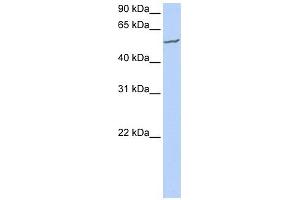 FBXW11 antibody used at 1 ug/ml to detect target protein. (FBXW11 antibody  (N-Term))