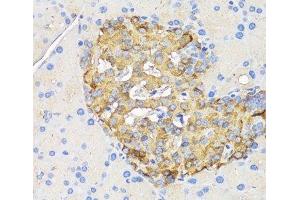 Immunohistochemistry of paraffin-embedded Rat pancreatic islet using INS Polyclonal Antibody at dilution of 1:50 (40x lens). (Insulin antibody)