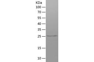 IGHG1 Protein (AA 120-330) (His tag)