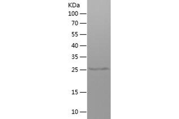 IGHG1 Protein (AA 120-330) (His tag)