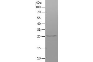 Western Blotting (WB) image for Immunoglobulin Heavy Constant gamma 1 (G1m Marker) (IGHG1) (AA 120-330) protein (His tag) (ABIN7282696) (IGHG1 Protein (AA 120-330) (His tag))