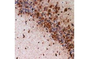 Immunohistochemical analysis of K Cadherin staining in mouse brain formalin fixed paraffin embedded tissue section. (CDH6 antibody)