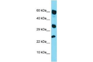 Western Blotting (WB) image for anti-Retinoic Acid Receptor Responder (Tazarotene Induced) 1 (RARRES1) (Middle Region) antibody (ABIN2499940) (RARRES1 antibody  (Middle Region))