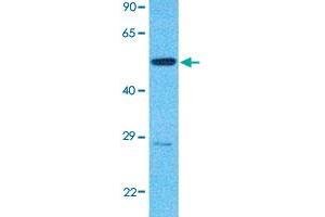 Western Blot analysis of human 786-O cell lysate with IKZF3 polyclonal antibody  at 1 ug/mL working concentration. (IKZF3 antibody  (N-Term))