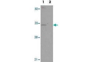 Western blot analysis of SLC39A3 in mouse lung tissue lysate with SLC39A3 polyclonal antibody  at 1 ug/mL in (1) the absence and (2) the presence of blocking peptide. (SLC39A3 antibody  (Internal Region))