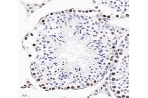 Immunohistochemistry analysis of paraffin-embedded mouse testis using,GINS2 (ABIN7074041) at dilution of 1: 3000 (GINS2 antibody)