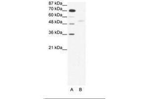 Image no. 1 for anti-SMAD, Mothers Against DPP Homolog 5 (SMAD5) (AA 193-242) antibody (ABIN203157) (SMAD5 antibody  (AA 193-242))