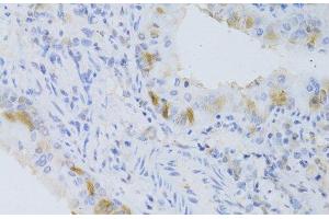 Immunohistochemistry of paraffin-embedded Mouse lung using CYP2C9 Polyclonal Antibody at dilution of 1:100 (40x lens).