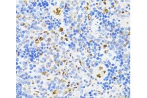 Immunohistochemistry of paraffin-embedded Rat spleen using DDX39B Polyclonal Antibody at dilution of 1:100 (40x lens).