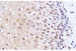 Immunohistochemistry of paraffin-embedded Human esophageal using BRD4 Polyclonal Antibody at dilution of 1:100 (40x lens). (BRD4 antibody)