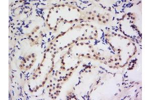 Formalin-fixed and paraffin embedded human kidney labeled with Anti-Dymeclin Polyclonal Antibody, Unconjugated  at 1:200 followed by conjugation to the secondary antibody and DAB staining. (Dymeclin antibody  (AA 151-250))