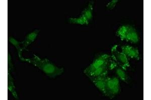 Immunofluorescent analysis of Hela cells using ABIN7161975 at dilution of 1:100 and Alexa Fluor 488-congugated AffiniPure Goat Anti-Rabbit IgG(H+L) (NOL4L (AA 101-300) antibody)