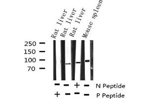 Western blot analysis of Phospho-STAT5A (Tyr694) expression in various lysates (STAT5A antibody  (pTyr694))