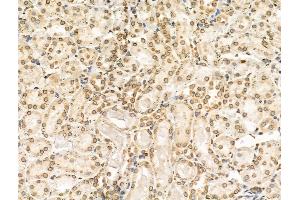 ABIN6257023 and ABIN6274557 at 1/100 staining Rat kidney tissue by IHC-P.