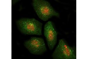 IF analysis of DBF4 using anti-DBF4 antibody (ABIN7601162) and anti-Beta Tubulin antibody (ABIN7602743).