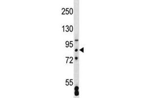 SATB2 antibody western blot analysis in MCF-7 lysate (SATB2 antibody  (AA 410-439))